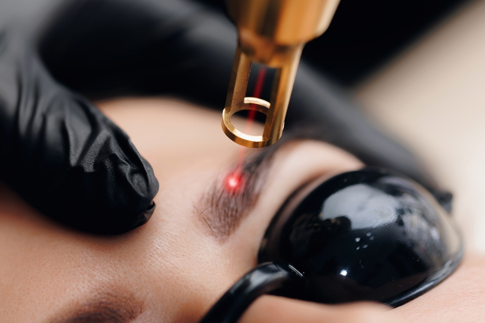 Masterclass PMU Verwijderen