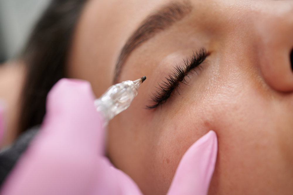 PMU Eyeliner behandeling